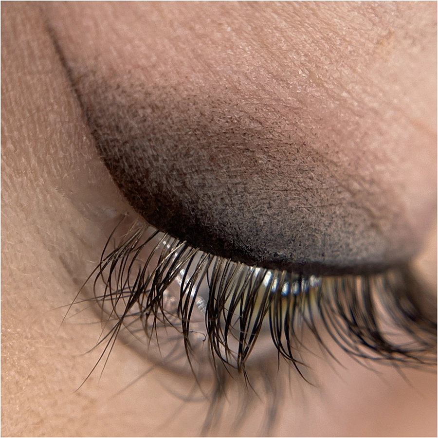 Nuline: All About Lips